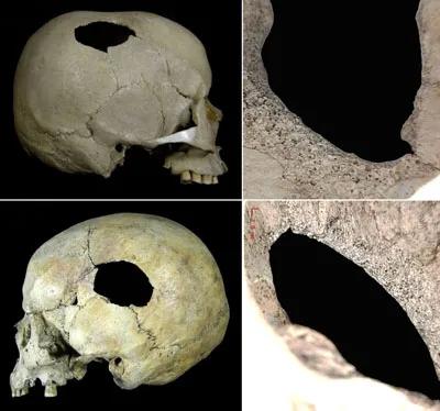 HCA Cambridge World History of Violence Perimortem blunt force injuries on skulls from the Late Jomon sit
