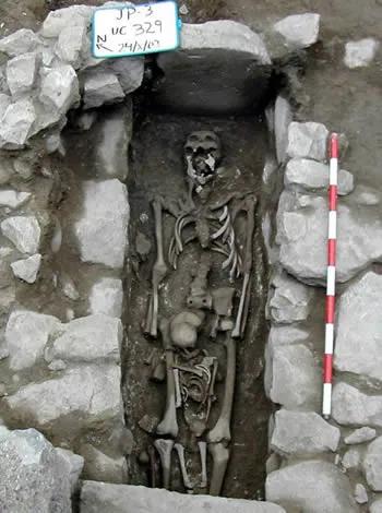 Skeleton 329